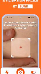 Scanner santé peau: Skinive AI screenshot