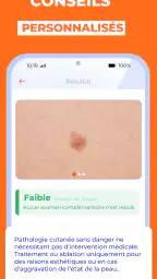 Scanner santé peau: Skinive AI screenshot