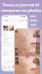 Skincare Routine: FeelinMySkin screenshot