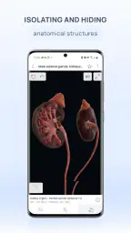 VOKA 3D Anatomie et Pathologie screenshot