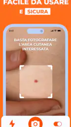 Scanner Pelle IA: Salute & Nei screenshot