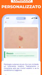 Scanner Pelle IA: Salute & Nei screenshot