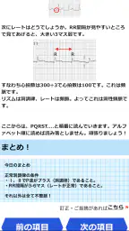 みんなde心電図 screenshot