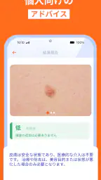 スキャナー スキン: ai顔診断 ボディ.スキンケア screenshot