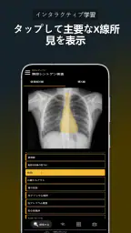 胸部X線 | 学ぶ胸X screenshot