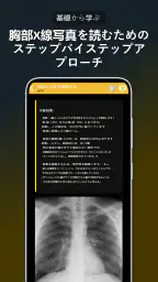 胸部X線 | 学ぶ胸X screenshot