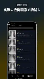 胸部X線 | 学ぶ胸X screenshot