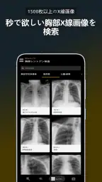 胸部X線 | 学ぶ胸X screenshot