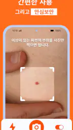 AI 피부과 피부 스캐너: 건강상태 자가진단 및 미용 screenshot