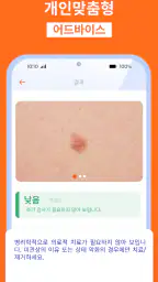 AI 피부과 피부 스캐너: 건강상태 자가진단 및 미용 screenshot