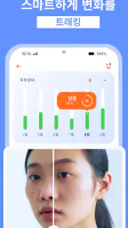 AI 피부과 피부 스캐너: 건강상태 자가진단 및 미용 screenshot