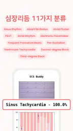 ECG Buddy - 의료진을 위한 AI 심전도 분석 screenshot