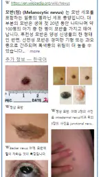 Model Dermatol – Skin Disease screenshot