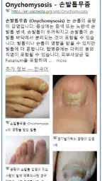 Model Dermatol – Skin Disease screenshot