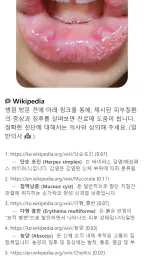 Model Dermatol – Skin Disease screenshot