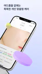 스킨로그 | 여드름  피부 일기 screenshot