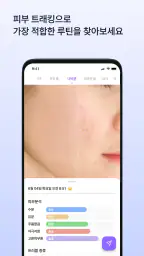 스킨로그 | 여드름  피부 일기 screenshot