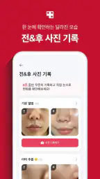 에이지알 - 메디큐브 디지털클리닉 AGE-R screenshot