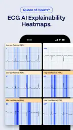 PMcardio for Individuals screenshot