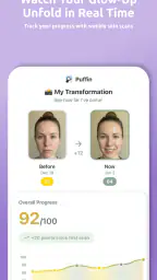 Puffin: Acne Tracker screenshot