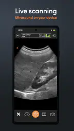 App de Ultrassom Clarius screenshot