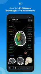 IMAIOS e-Anatomy screenshot