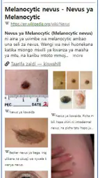 Model Dermatol – Hudsjukdom screenshot