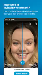 My Invisalign screenshot