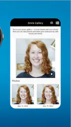 My Invisalign screenshot